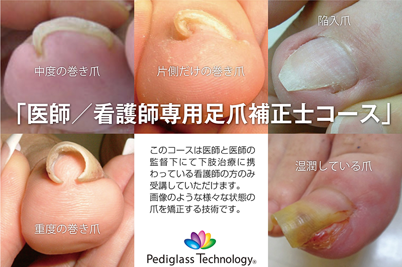医師 看護師専用の足爪補正士コース 痛くない巻き爪補正 フットケアのペディグラス